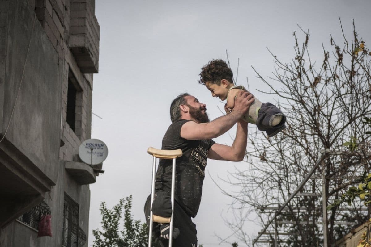 Foto Viral: La guerra en Siria lo dejó sin piernas. ¡La vida hoy le sonríe!
